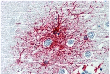 GFAP antibody [GF-01]