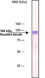 gamma Adaptin antibody [100/3]