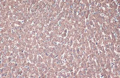 ACADVL antibody [N1C1]