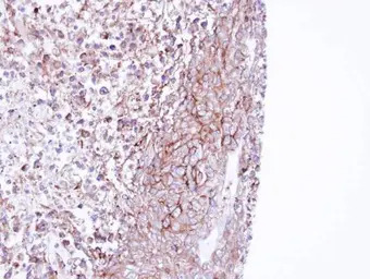 MPP1 antibody [N1C1]