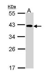 EIF2B beta antibody [N2C3]