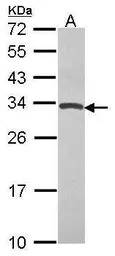 TIMP4 antibody [N1C3]
