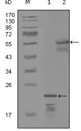 Her3 / ErbB3 antibody [3F10F6]