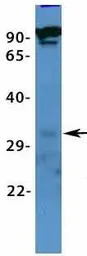 VDAC3 antibody, N-term