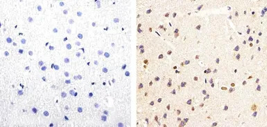 Tau (phospho Ser199/Ser202) an