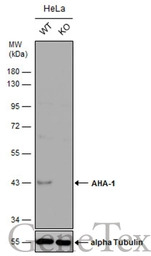 AHA-1 antibody [N1C1]