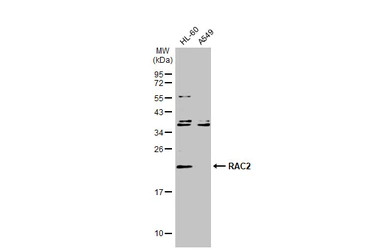 RAC2 antibody [N1C3]