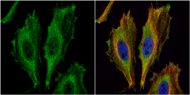 Aspartoacylase antibody [N1C3-