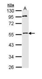 MPP1 antibody [N1C1]