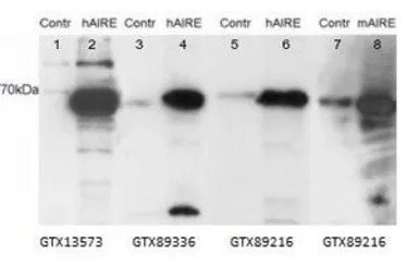 AIRE (isoform 1) antibody, Int