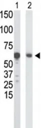 Glucokinase antibody, N-term