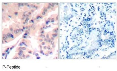 eIF4B (phospho Ser422) antibod