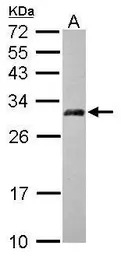 AP3M2 antibody [N1C1]