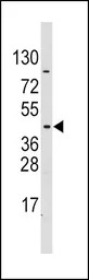 PDK4 antibody