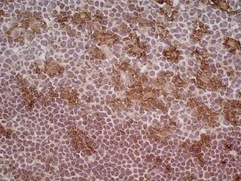 CD205 antibody [MG38] (Low end