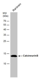 Calcineurin B antibody