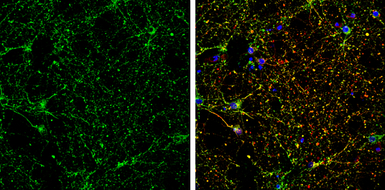 CRMP5 antibody [N1C1]