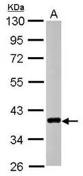 CTGF antibody