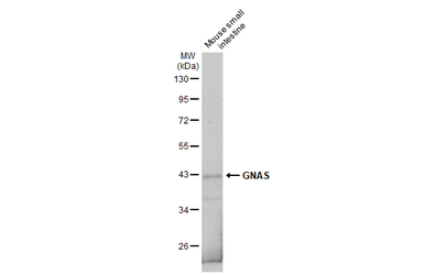 GNAS antibody [C2C3-2], C-term