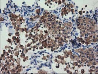 FAM84B antibody [4A4]