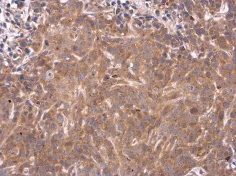 PAI3 antibody [N3C3]