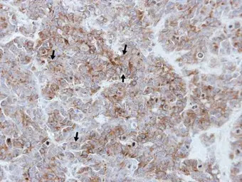 Thrombin Receptor antibody [N1