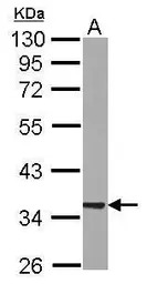 RABGGTB antibody