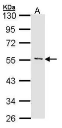 MEF2A antibody [N1N2], N-term
