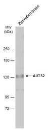 AUTS2 antibody [N3C1], Interna