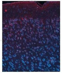 FIBCD1 antibody, C-term