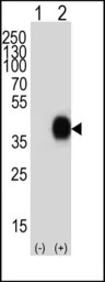 CD38 antibody, C-term