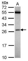 FAAP24 antibody [N1C3]