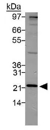 PSMD10 antibody