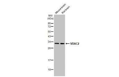 VDAC2 antibody [C2C3], C-term