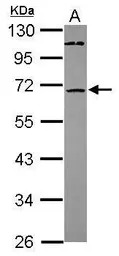 ST6GALNAC1 antibody [N2C2], In