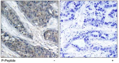 IRS1 (phospho Ser307) antibody