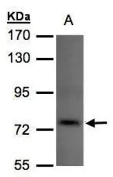 TLK1 antibody [N2C2], Internal