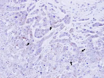 Sodium/Potassium ATPase beta 1