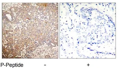 Cytokeratin 18 (phospho Ser33)