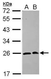 SAR1A antibody [N1C3]