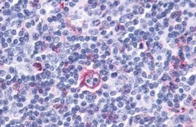 Leukotriene B4 Receptor 2 anti