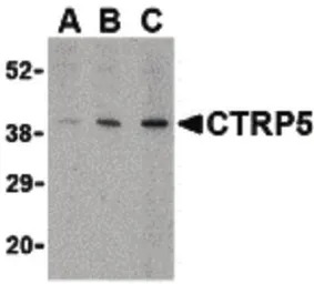 CTRP5 antibody