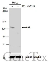 AXL antibody