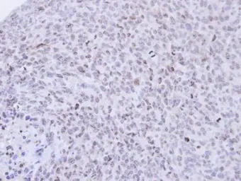 PCNP antibody [N1N2], N-term