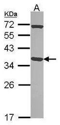 Pirin antibody