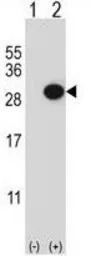 CTHRC1 antibody, N-term