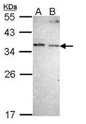 NOSIP antibody [N2C1], Interna