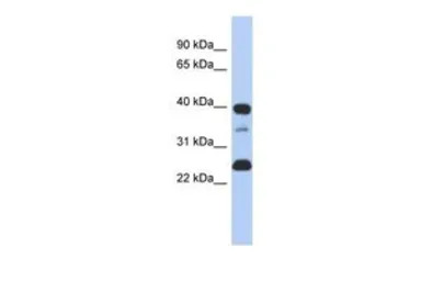 LAP2 antibody, N-term