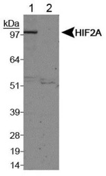 HIF2 alpha antibody