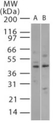 p38 beta antibody